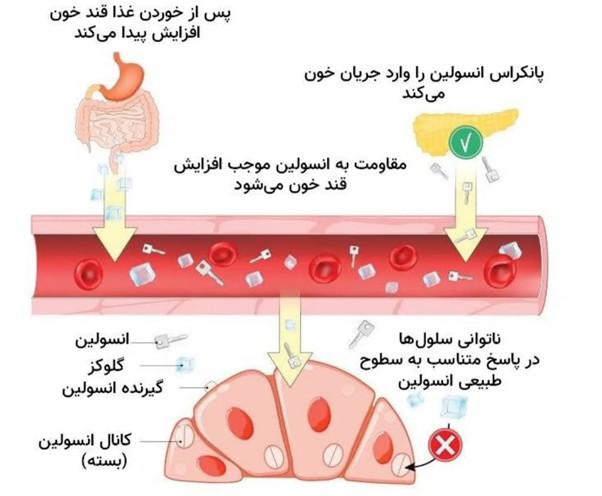 مقاومت به انسولین