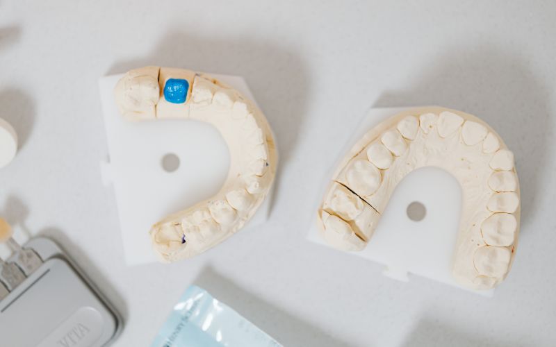 مزایای ایمپلنت فوری