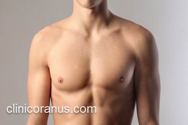 درمان ژنیکوماستی توسط پزشکان متخصص | کلینیک اورانوس