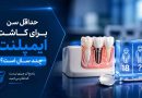 حداقل سن برای کاشت ایمپلنت چند سال است؟ پاسخ آن چیزی نیست که فکر میکنید حداقل سن برای کاشت ایمپلنت چند سال است؟ پاسخ آن چیزی نیست که فکر میکنید