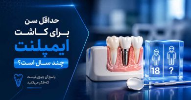 حداقل سن برای کاشت ایمپلنت چند سال است؟ پاسخ آن چیزی نیست که فکر میکنید حداقل سن برای کاشت ایمپلنت چند سال است؟ پاسخ آن چیزی نیست که فکر میکنید