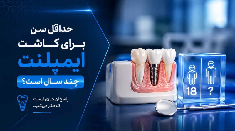حداقل سن برای کاشت ایمپلنت چند سال است؟ پاسخ آن چیزی نیست که فکر میکنید حداقل سن برای کاشت ایمپلنت چند سال است؟ پاسخ آن چیزی نیست که فکر میکنید