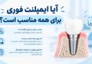 آیا ایمپلنت فوری برای همه مناسب است؟