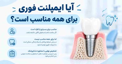 آیا ایمپلنت فوری برای همه مناسب است؟