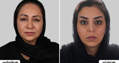 مقایسه بلفاروپلاستی با جراحی لیفت ابرو | کدام روش بهتر است؟