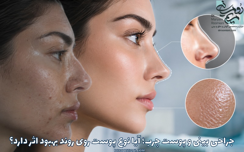 جراحی بینی و پوست چرب؛ آیا نوع پوست روی روند بهبود اثر دارد؟