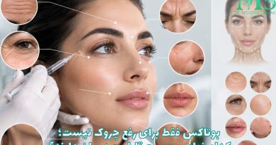 بوتاکس فقط برای رفع چروک نیست؛ کدام نواحی صورت قابلیت درمان دارند؟