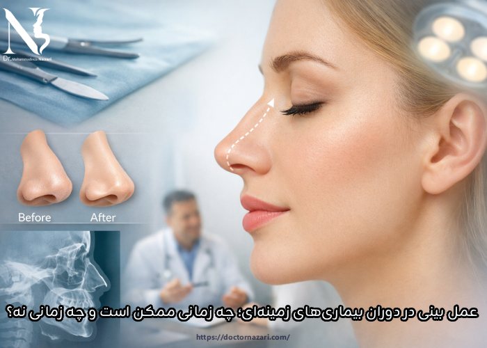 عمل بینی در دوران بیماریهای زمینهای؛ چه زمانی ممکن است و چه زمانی نه؟ عمل بینی در دوران بیماریهای زمینهای؛ چه زمانی ممکن است و چه زمانی نه؟
